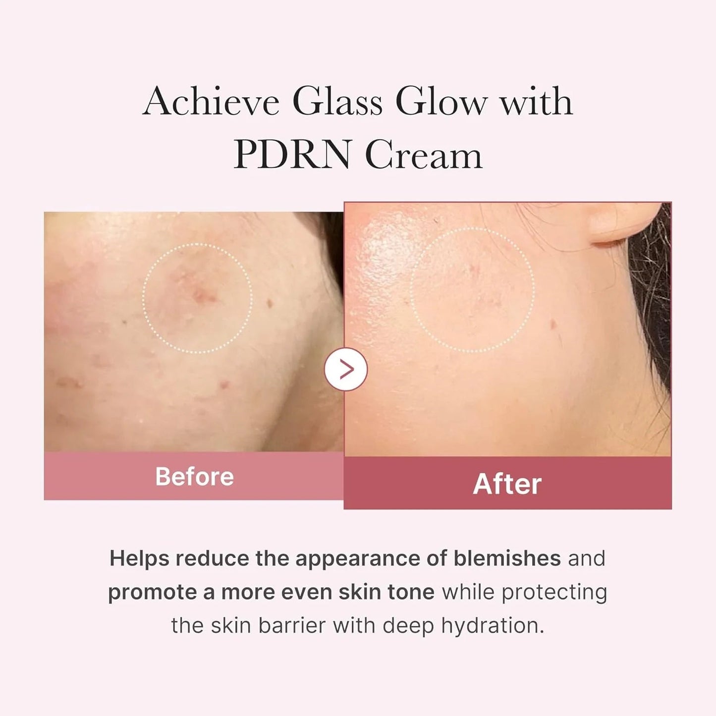 Medicube – Crema Hidratante PDRN Pink con Ácido Hialurónico 50ml – Regeneración y Luminosidad