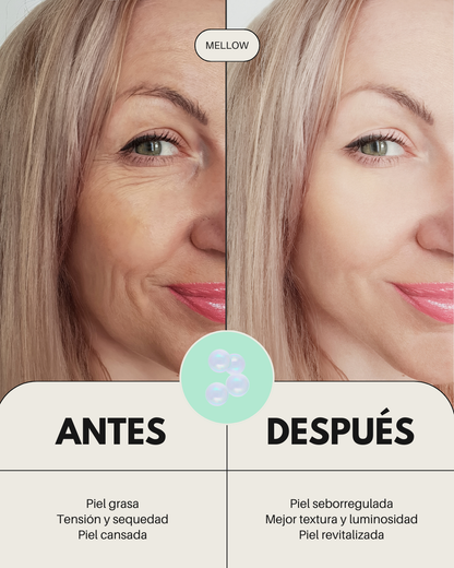 Pack Rutina Facial ECO - PIEL ACNEICA