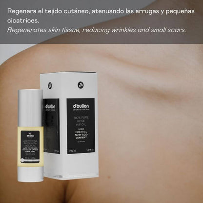 Aceite de Rosa Mosqueta 100% Puro Valquer 30ml - Regenerador Facial Antiarrugas